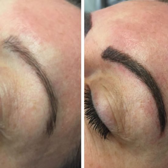 Microblading