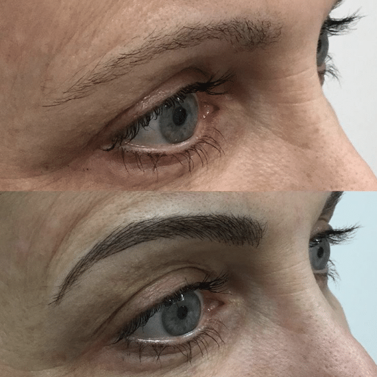 Microblading