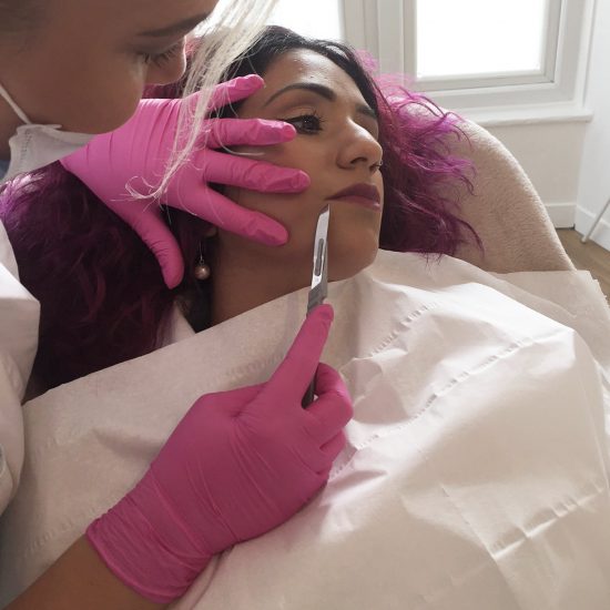 Dermaplaning Treatment