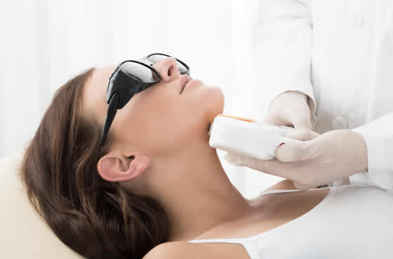 IPL Hair Removal Treatment