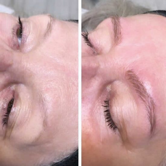 Microblading Eyebrows