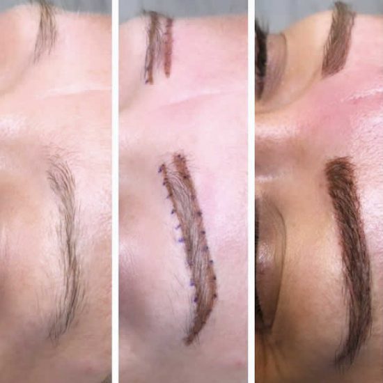 Microblading Eyebrows