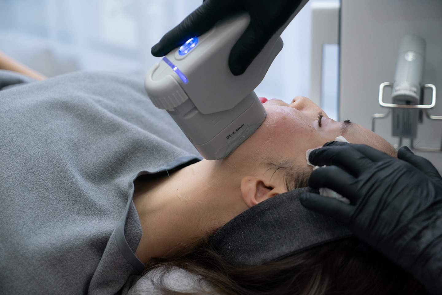 Advanced 7D HIFU Treatment in Macclesfield