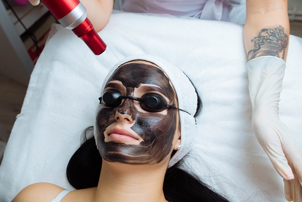Close-up of cosmetologist's hand making hardware carbon peeling by young pretty customer woman in safety glasses headdress lying on couch in beauty salon. Facial cleaning concept. Cosmetology Services
