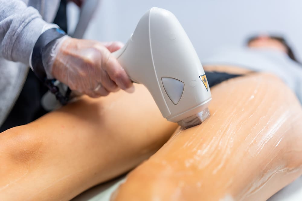 Close-up of woman leg laser hair removal