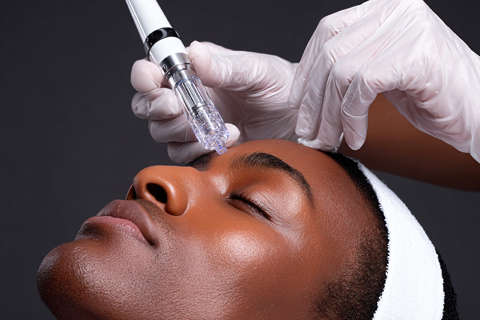 Fractional CO₂ Laser & Microneedling: Why They're the Ultimate Power Couple for Skin Rejuvenation